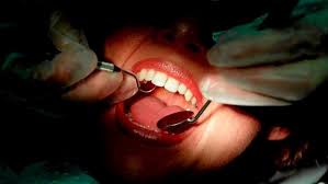 FOREIGN NATIONAL BOGUS DENTIST WAS CONVICTED AND SENTENCED