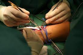 Hand & micro surgery