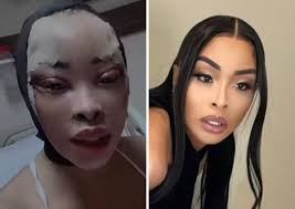 Khanyi Mbau has again sparked reactions on social media after going under the knife to make cosmetic changes.